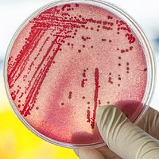 Mehr zu 'Antibiotikaresistente Bakterien: eine gesamtgesellschaftliche Herausforderung'