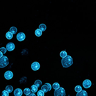More 'Fluoreszierende Picosensoren als Spione in lebenden Zellen'