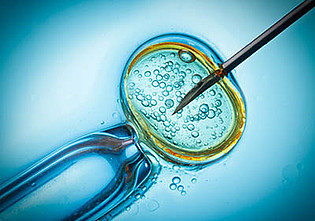 Mehr zu '30 Jahre Embryonenschutzgesetz: Medizinischer Fortschritt, gesellschaftlicher Wandel und politischer Handlungsbedarf'