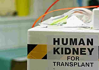 Leopoldina plädiert für Neuregelungen in der Transplantationsmedizin
